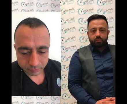 Patiënten reviews | HairTime Istanbul