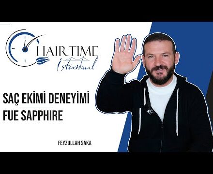 Feyzullah Bey is here with the results of 2 years | Hair Time İstanbul